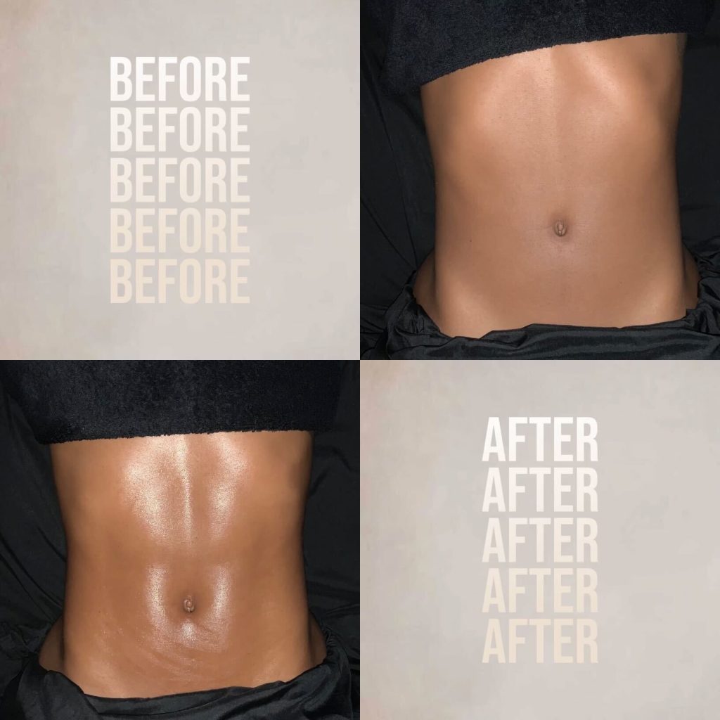 The Tox Technique is a 90% hands-on lymphatic-based body sculpting and detox treatment
